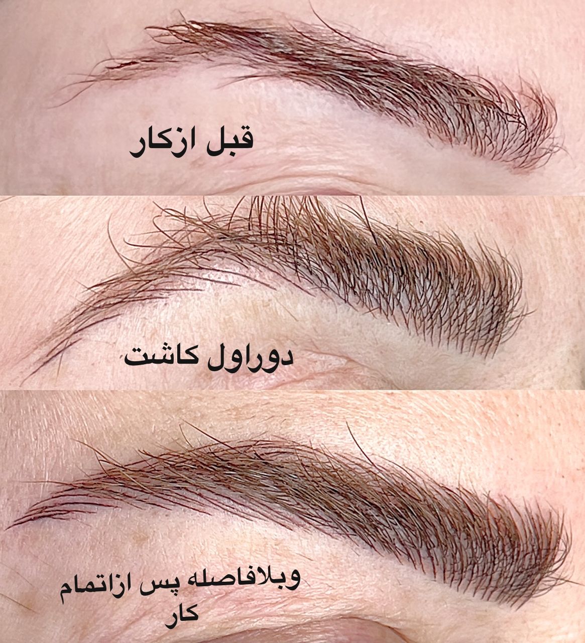 میکروبلدینگ ابرو