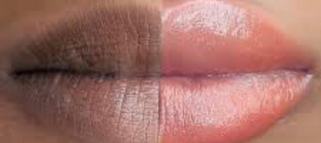 شیدینگ لب یا دکاپاژ لب برای آقایان برطرف کردن کبودی لبها کاملا طبیعی